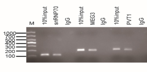 RNA-RNA pull-down產(chǎn)物q-pcr跑膠.jpg